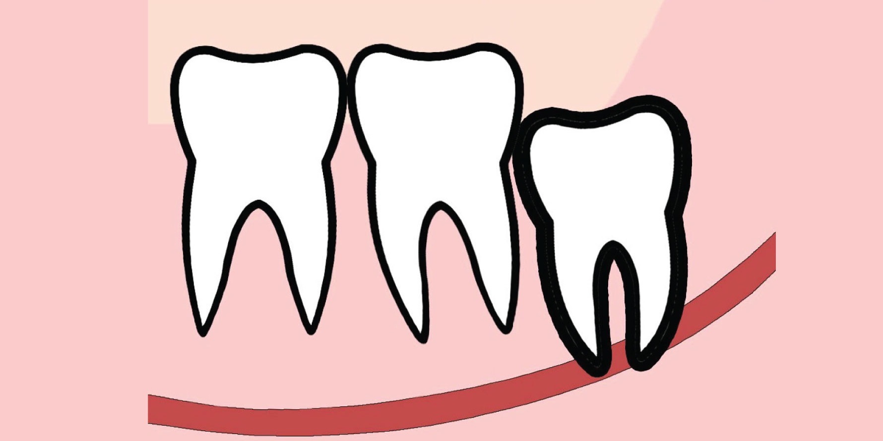 thumbnail-image