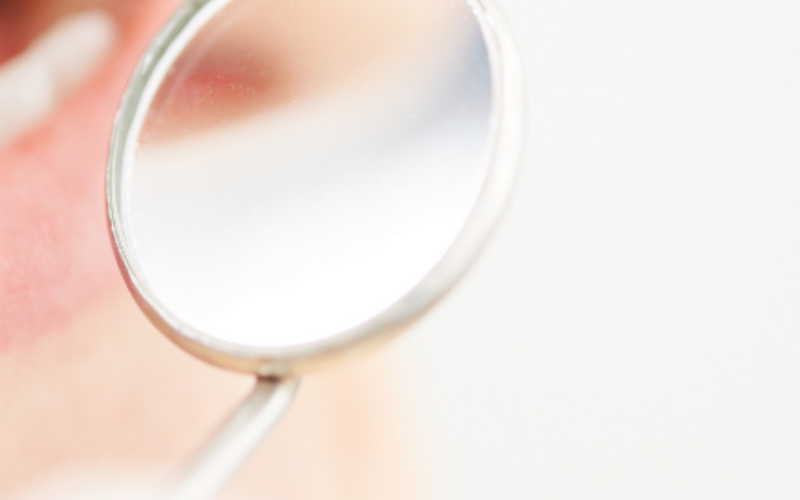thumbnail-image